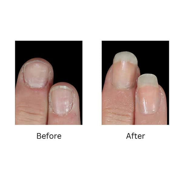 High Maintenance Instant Nail Thickener