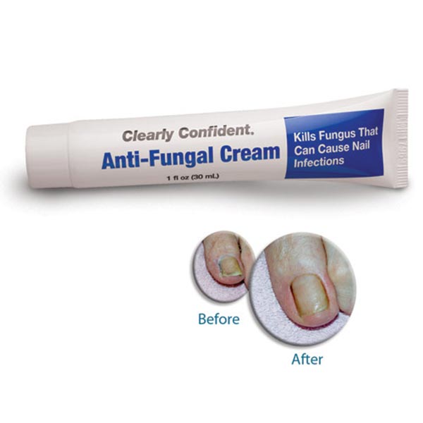Clearly Confident Anti-Fungal Cream