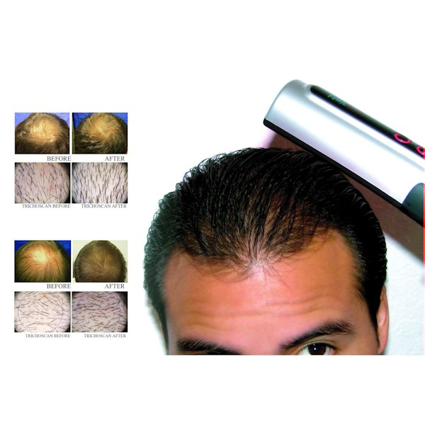 Product image for HairPro Laser Hair Treatment Brush