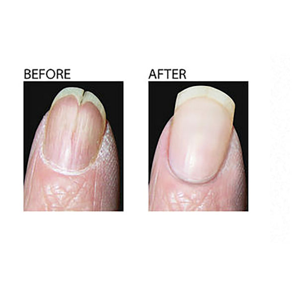Product image for Makeover Ridge Filler for Nails