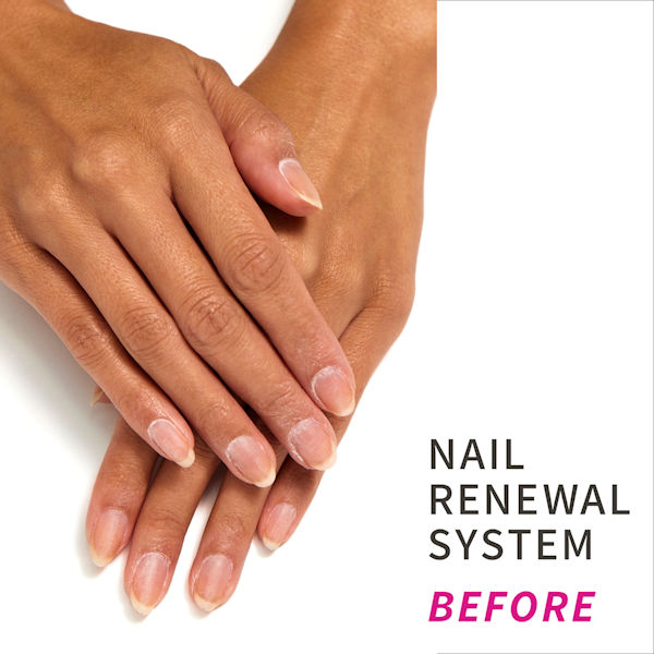 Product image for Dr. Dana Nail Renewal System