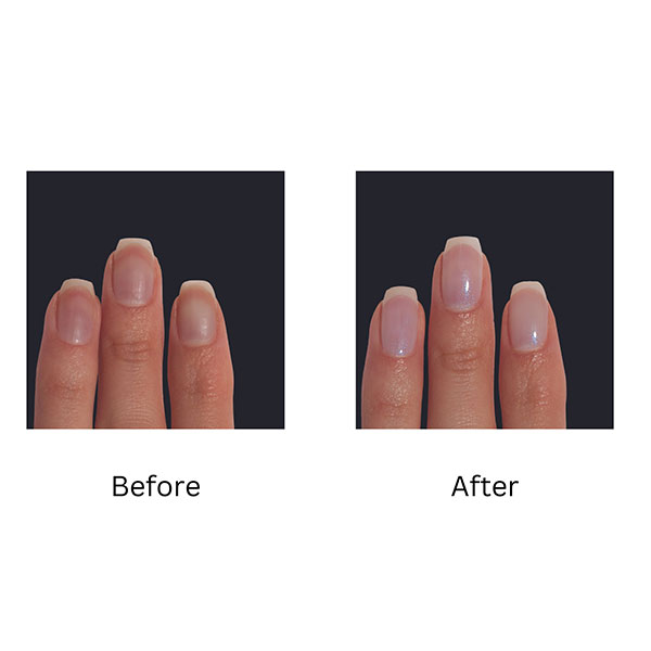 Product image for Dermelect Luminous Nail Brightener & Perfector