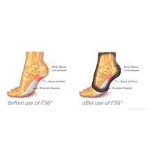 Alternate Image 7 for FS6 Foot Sleeves with Compression for Plantar Fasciitis Relief
