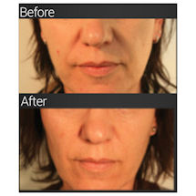 Alternate image Malibu Beauty Wrinkle Reducing Set