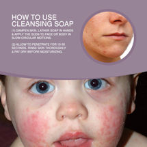 Alternate Image 4 for Eczema & Psoriasis Relief Soap