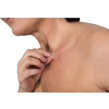 Alternate image for Dermal Skin Tag Patches