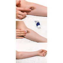 Alternate image for TriDerma® Bruise Defense™ Healing Cream