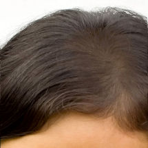 Alternate Image 2 for Vitamin E Thick Hair 2-in-1 Shampoo & Conditioner