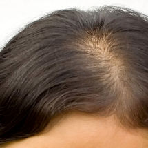 Alternate Image 1 for Vitamin E Thick Hair 2-in-1 Shampoo & Conditioner