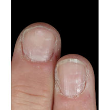 Alternate Image 2 for High Maintenance Instant Nail Thickener