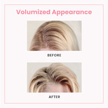 Alternate image for Volumizing Root Lifter Clips