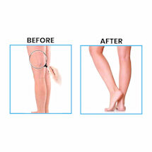 Alternate image for Thera Rx Varicose Veins Cooling Cream