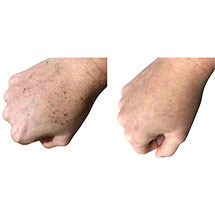 Alternate image for Anti-Aging Hand Cream with Sunscreen